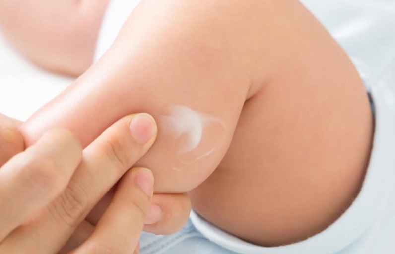 Bebeklerde Atopik Dermatit Nedir? 